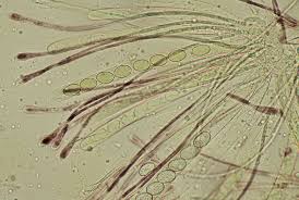 Attēlu rezultāti vaicājumam “Scutellinia scutellata”