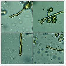 Attēlu rezultāti vaicājumam “Oligonema favogineum spores”