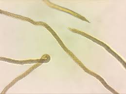 Attēlu rezultāti vaicājumam “Trichia contorta”