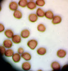 Attēlu rezultāti vaicājumam “Badhamia dubia spores”