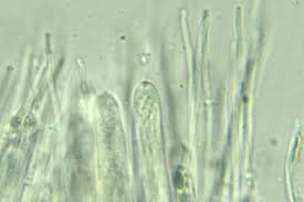Attēlu rezultāti vaicājumam “Stictis”