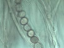 Attēlu rezultāti vaicājumam “Octospora splachnophila spores”