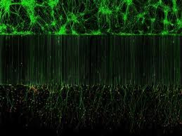 Attēlu rezultāti vaicājumam “Diderma tigrinum macro”