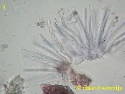 Attēlu rezultāti vaicājumam “Nectria episphaeria”