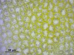 Attēlu rezultāti vaicājumam “Lophozia longidens”