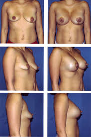 http://t0.gstatic.com/images?q=tbn:ANd9GcSk7-F3xMotJCEIAyiUBn5I5cqfa1w6irEWkVYbgW2t3KvaKwajkg