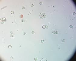 Attēlu rezultāti vaicājumam “Heterotrichia obvelata (syn. Arcyria obvelata)”