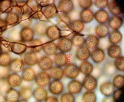 Attēlu rezultāti vaicājumam “Stemonitis fusca spores”