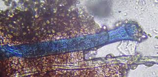 Attēlu rezultāti vaicājumam “Comatricha tenerrima stalked”