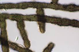 Attēlu rezultāti vaicājumam “Cystocoleus ebeneus”