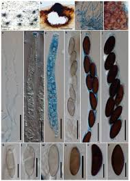 Attēlu rezultāti vaicājumam “Jungermannia sphaerocarpa sporophyte”