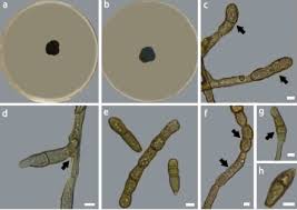 Attēlu rezultāti vaicājumam “Cetrelia sp.”