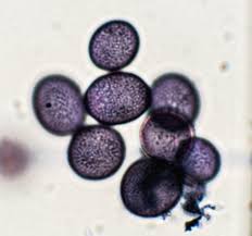 Attēlu rezultāti vaicājumam “Physarum leucophaeum sessile”