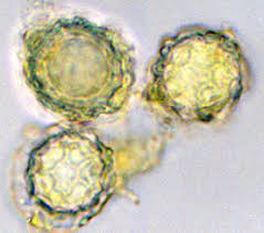 Attēlu rezultāti vaicājumam “Lycogala persicum spores”