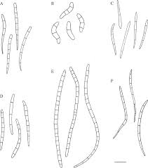 Attēlu rezultāti vaicājumam “Megalaria grossa”