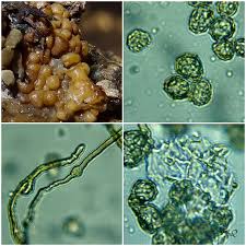 Attēlu rezultāti vaicājumam “Oligonema favogineum spores”