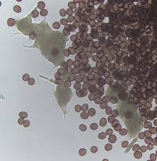 Attēlu rezultāti vaicājumam “Physarum confertum”