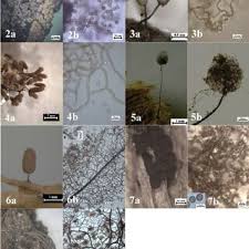 Attēlu rezultāti vaicājumam “Enerthenema papillatum spores”