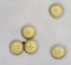 Attēlu rezultāti vaicājumam “Perichaena corticalis macro”