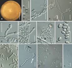 Attēlu rezultāti vaicājumam “Nectria sp., Neonectria sp.”