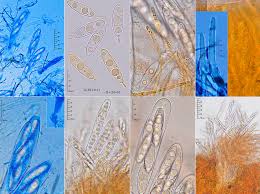 Attēlu rezultāti vaicājumam “Octosporella jungermanniarum”