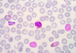 Attēlu rezultāti vaicājumam “Diderma radiatum plasmodium”