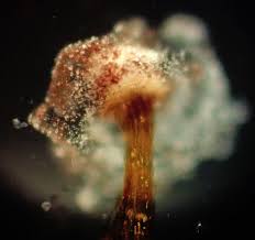 Attēlu rezultāti vaicājumam “Didymium xanthopus spores”