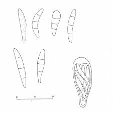 Attēlu rezultāti vaicājumam “Scoliciosporum chlorococcum”