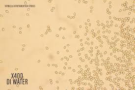 Attēlu rezultāti vaicājumam “Amaurochaete atra spores”