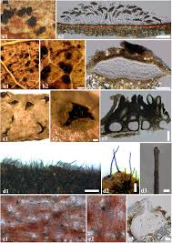 Attēlu rezultāti vaicājumam “Rosellinia desmazieri spores”