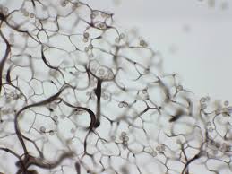 Attēlu rezultāti vaicājumam “Stemonitis axifera var. smithii spores”