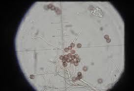 Attēlu rezultāti vaicājumam “Diderma rufostriatum”