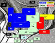 Arcuate nucleus - Wikipedia, the free encyclopedia