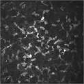 Science Direct.com - Progress in Retinal and Eye Research - Contact ... 