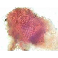 Attēlu rezultāti vaicājumam “Hildenbrandia rivularis”