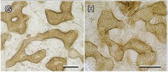 Attēlu rezultāti vaicājumam “Lycogala miserum”