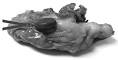<b>Coristoma</b> hepático de