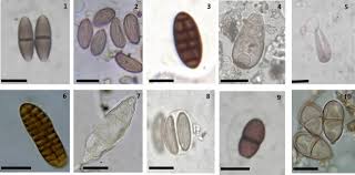 Attēlu rezultāti vaicājumam “Badhamiopsis ainoae spores”