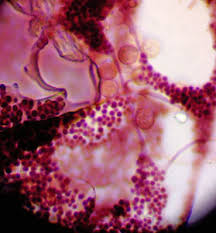 Attēlu rezultāti vaicājumam “Cribraria piriformis macro”