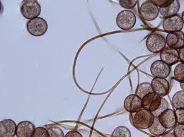 Attēlu rezultāti vaicājumam “Lamproderma elasticum”