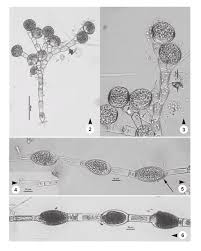 Attēlu rezultāti vaicājumam “Bulbochaete mirabilis”