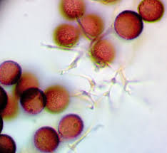 Attēlu rezultāti vaicājumam “Diderma rufostriatum spores”