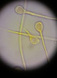 Attēlu rezultāti vaicājumam “Fossombronia wondraczekii spores”