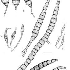 Attēlu rezultāti vaicājumam “Didymium annulisporum spores”
