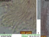 Attēlu rezultāti vaicājumam “Hyphodiscus hymeniophilus”