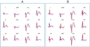 Image result for  ^ L V [ h    