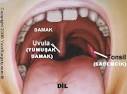 Bademcik İltihabı ve Bitkisel Tedavisi