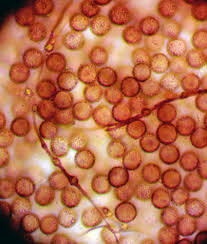 Attēlu rezultāti vaicājumam “Didymium xanthopus”