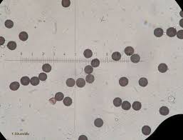 Attēlu rezultāti vaicājumam “Badhamia lilacina var. megaspora spores”