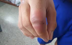 Znalezione obrazy dla zapytania palec